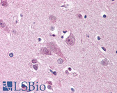 Anti-MARK1 / MARK Antibody (N-Terminus) IHC-plus LS-A9499
