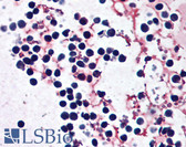 Anti-NALP3 / NLRP3 Antibody (Internal) IHC-plus LS-B1767