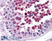 Anti-NPY2R Antibody (aa350-400) IHC-plus LS-B1770
