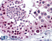 Anti-MTA2 Antibody (aa650-700) IHC-plus LS-B1771