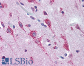 Anti-KDM1A / LSD1 Antibody (aa800-850) IHC-plus LS-B1777