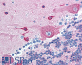 Anti-PACSIN2 Antibody (aa400-450) IHC-plus LS-B1787