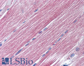 Anti-RAB7A / RAB7 Antibody (aa90-140) IHC-plus LS-B1789