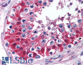 Anti-CYP1B1 Antibody (aa200-250) IHC-plus LS-B1804