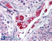 Anti-HIPK3 / FIST Antibody (aa850-900) IHC-plus LS-B1805