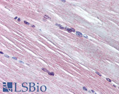 Anti-AMPD1 Antibody (aa140-190) IHC-plus LS-B1806