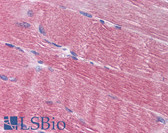 Anti-AMPD1 Antibody (aa500-550) IHC-plus LS-B1807
