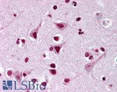 Anti-FMNL2 Antibody IHC-plus LS-B1817