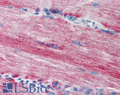 Anti-ACSL3 Antibody (N-Terminus) IHC-plus LS-B1820