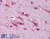 Anti-MAPK9 / JNK2 / SAPK Antibody (C-Terminus) IHC-plus LS-B1828