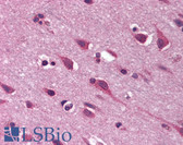 Anti-CCN3 / NOV Antibody (C-Terminus) IHC-plus LS-B1831