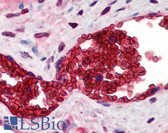 Anti-SLC4A1 / Band 3 / AE1 Antibody (N-Terminus) IHC-plus LS-B1837