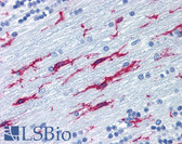 Anti-ITGB2 / CD18 Antibody (clone MEM-48) IHC-plus LS-B1849