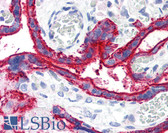 Anti-CD59 Antibody (clone MEM-43) IHC-plus LS-B1852