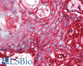 Anti-CD59 Antibody (clone MEM-43/5) IHC-plus LS-B1853