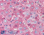 Anti-ALB / Serum Albumin Antibody (clone AL-01) IHC-plus LS-B1855