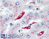 Anti-CD74 Antibody (clone LN2) IHC-plus LS-B1859