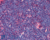 Anti-CD30 Antibody (clone MEM-268) IHC-plus LS-B1865