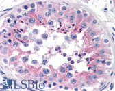 Anti-CLU / Clusterin Antibody (clone Hs-3) IHC-plus LS-B1869