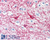 Anti-MAP2 Antibody (clone MT-07) IHC-plus LS-B1871