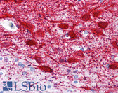 Anti-MAP2 Antibody (clone MT-08) IHC-plus LS-B1872