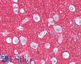 Anti-NCAM / CD56 Antibody (clone HCD56) IHC-plus LS-B1881