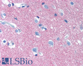 Anti-NCAM / CD56 Antibody (clone MEM-188) IHC-plus LS-B1882