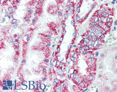 Anti-PHB / Prohibitin Antibody (C-Terminus) IHC-plus LS-B1888