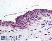 Anti-RARA / RAR Alpha Antibody (aa1-100) IHC-plus LS-B1893