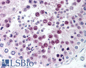 Anti-SIRT1 / Sirtuin 1 Antibody (C-Terminus) IHC-plus LS-B1895