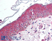 Anti-WNT10B Antibody (Internal) IHC-plus LS-A9626