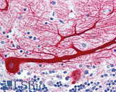 Anti-WNT10B Antibody (Internal) IHC-plus LS-A9627
