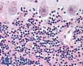 Anti-WNT2 / IRP Antibody (Internal) IHC-plus LS-A9608