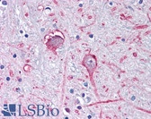 Anti-GABRA3 Antibody (C-Terminus) IHC-plus LS-A9666