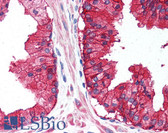 Anti-CD38 Antibody (Internal) IHC-plus LS-A9697