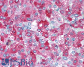 Anti-B3GAT1 Antibody (clone HCD57) IHC-plus LS-B1948
