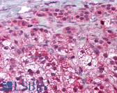 Anti-BAX Antibody (N-Terminus) IHC-plus LS-B1949