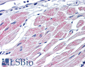 Anti-c-CBL Antibody (C-Terminus) IHC-plus LS-B1952