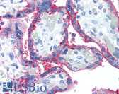 Anti-CD59 Antibody (clone p282(H19)) IHC-plus LS-B1960