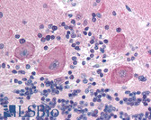Anti-CD99 Antibody (clone HCD99) IHC-plus LS-B1965
