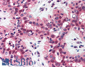 Anti-MSH2 Antibody (aa550-600) IHC-plus LS-B1973
