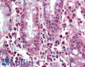 Anti-MUTYH Antibody (aa531-546) IHC-plus LS-B1974