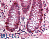 Anti-PRDM5 Antibody (aa100-200) IHC-plus LS-B1982