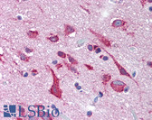 Anti-KCNH2 / HERG Antibody (Internal) IHC-plus LS-A9561