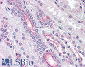 Anti-KCNE3 Antibody (Internal) IHC-plus LS-A9564