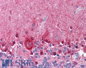 Anti-KCNMA1 / BK Antibody (Internal) IHC-plus LS-A9574
