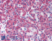 Anti-KCNN4 / KCa3.1 Antibody (N-Terminus) IHC-plus LS-A9579