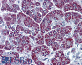 Anti-P2RX3 / P2X3 Antibody (C-Terminus) IHC-plus LS-A9584