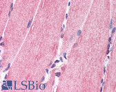Anti-NRG1 / Heregulin / Neuregulin Antibody (N-Terminus) IHC-plus LS-A9687