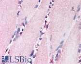 Anti-NRG1 / Heregulin / Neuregulin Antibody (Internal) IHC-plus LS-A9688